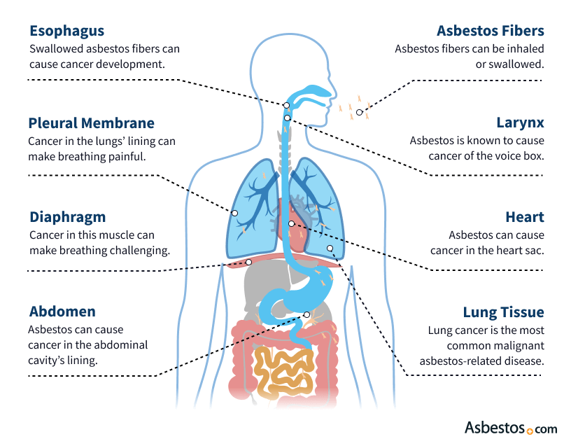 list of common health issues when coming in contact with asbestos.